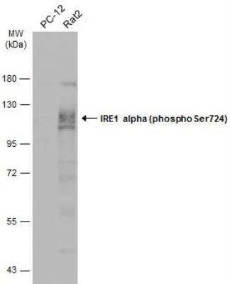 Western Blot: IRE1 alpha [p Ser724] Antibody [NBP3-12124]